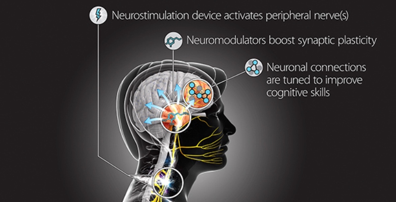 TNT technology will be designed to safely and precisely modulate peripheral nerves to control synaptic plasticity during cognitive skill training.